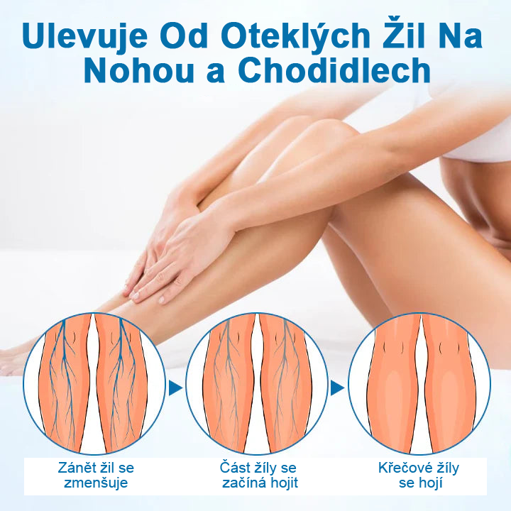 Timnilk® VeinGuard bylinný sprej – ✅ Klinicky prokázáno, že odstraní křečové žíly za pouhých 7 dní!
