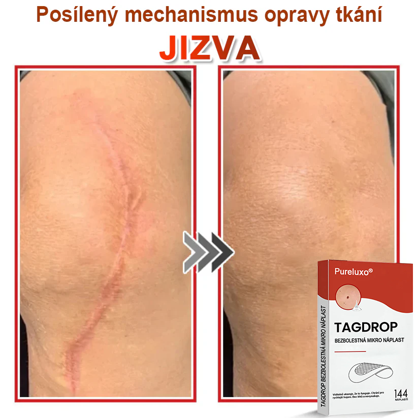 🇨🇿Pureluxo® Mikrovpichová botanická náplast na odstranění kožních výrůstků 🇨🇿 Vyrobeno v Česká republika