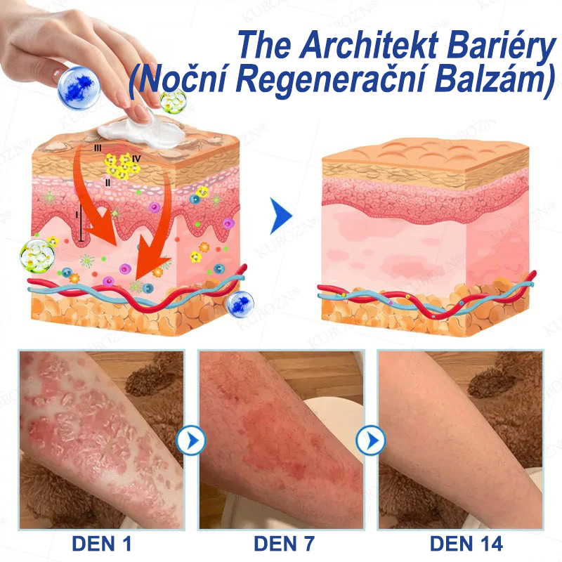 ⭐KUBOZN® Denní a noční regenerační systém pro psoriázu – 100% bez steroidů, dvojité řešení pro úlevu od plaků, šupinatění a svědění