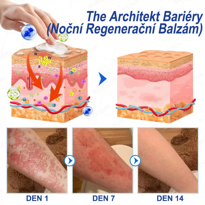 ⭐KUBOZN® Denní a noční regenerační systém pro psoriázu – 100% bez steroidů, dvojité řešení pro úlevu od plaků, šupinatění a svědění