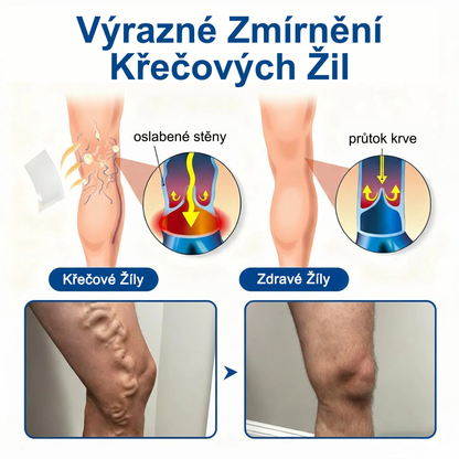 ✅FLORISMA® Klinická mikrojehličková náplast s diosminem a hesperidinem🌿 – zaměřená na křečové a metličkové žilky, pomáhá zmírnit pocit těžkých a unavených nohou