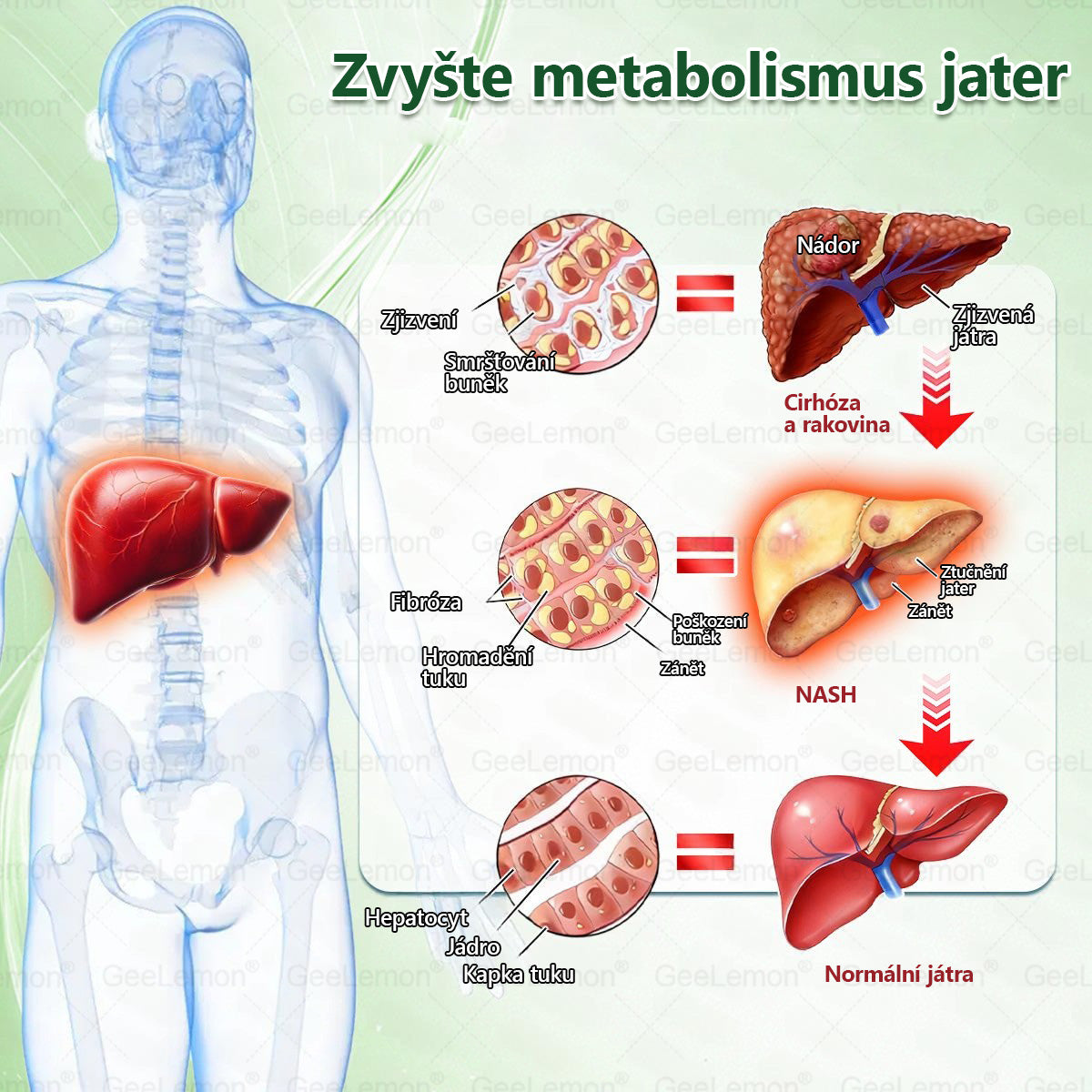 ✅Oficiální český obchod | GeeLemon® 8v1 Nanomikrojehlicové náplasti na formování těla 🇨🇿 Pouze 1 použití denně ✅ Výsledky viditelné již za 7 dní – vhodné pro obezitu, kardiovaskulární zdraví, cukrovku a problémy s klouby