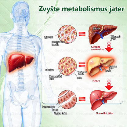 ✅Oficiální český obchod | GeeLemon® 8v1 Nanomikrojehlicové náplasti na formování těla 🇨🇿 Pouze 1 použití denně ✅ Výsledky viditelné již za 7 dní – vhodné pro obezitu, kardiovaskulární zdraví, cukrovku a problémy s klouby