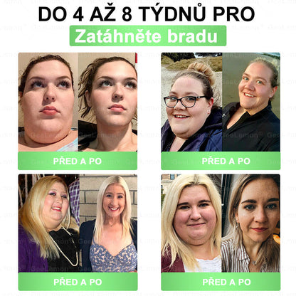 ✅Oficiální český obchod | GeeLemon® 8v1 Nanomikrojehlicové náplasti na formování těla 🇨🇿 Pouze 1 použití denně ✅ Výsledky viditelné již za 7 dní – vhodné pro obezitu, kardiovaskulární zdraví, cukrovku a problémy s klouby