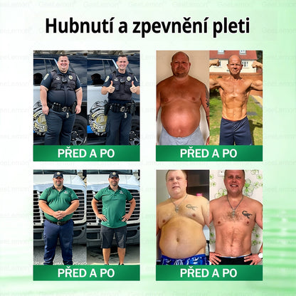 ✅Oficiální český obchod | GeeLemon® 8v1 Nanomikrojehlicové náplasti na formování těla 🇨🇿 Pouze 1 použití denně ✅ Výsledky viditelné již za 7 dní – vhodné pro obezitu, kardiovaskulární zdraví, cukrovku a problémy s klouby