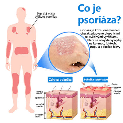 Zvoevo® Magnesium bylinný sprej ⚕️ Certifikace MHRA – úleva při psoriáze, ekzému, intimních bakteriálních infekcích, akné a tmavých skvrnách