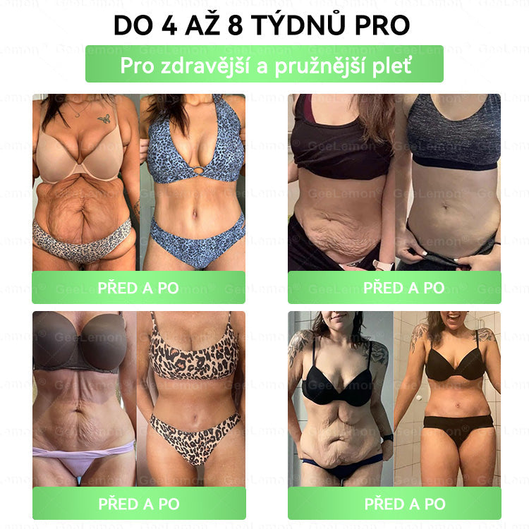 🔥Doporučeno Fakultní nemocnicí Motol · 👩‍⚕️ Oficiální prodejna BENU | 🎁 𝐆𝐞𝑒𝑙𝑒𝐦𝐨𝐧® Glum𝐚𝐬𝐞tide 8 v 1 – Zeštíhlující nano mikrojihlový náplast 🇨🇿 Jen 1× denně ✅ Viditelné změny za 7 dní – na obezitu, kardiovaskulární zdraví, diabetes a kloubní problémy