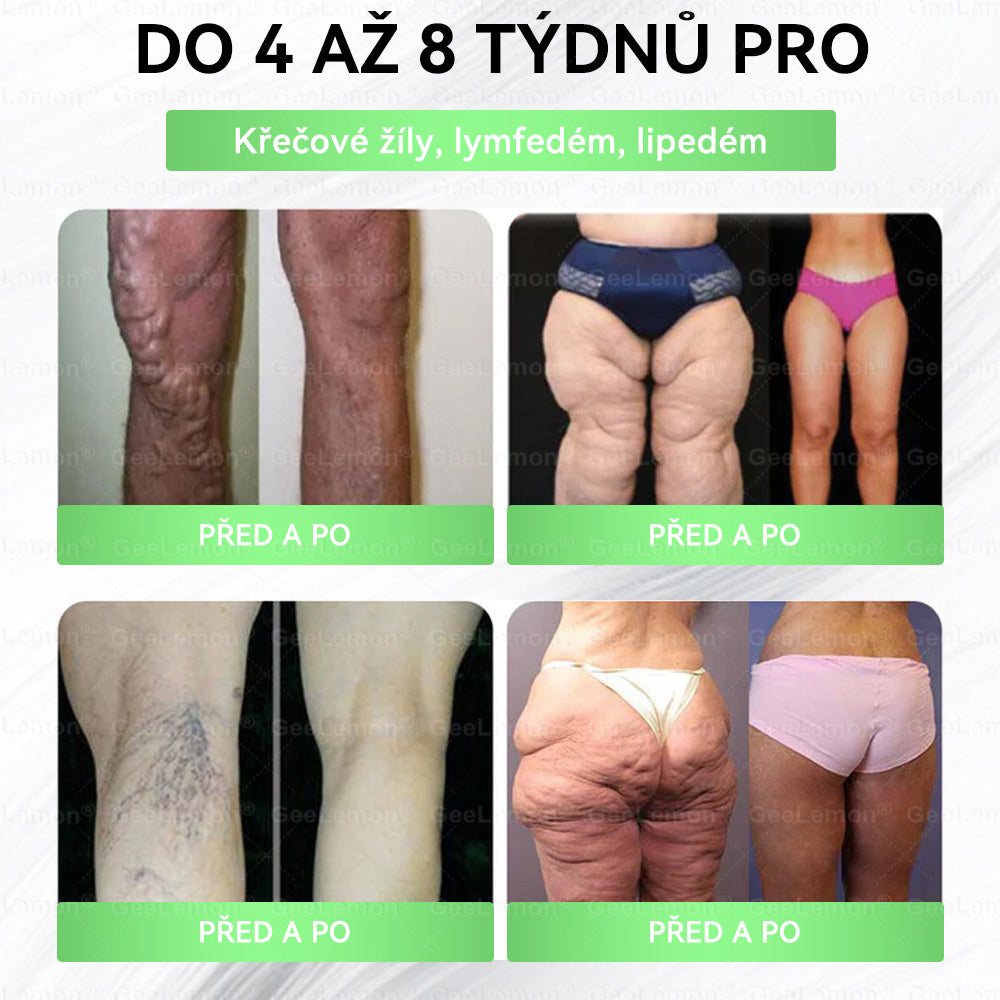 ✅Oficiální český obchod | GeeLemon® 8v1 Nanomikrojehlicové náplasti na formování těla 🇨🇿 Pouze 1 použití denně ✅ Výsledky viditelné již za 7 dní – vhodné pro obezitu, kardiovaskulární zdraví, cukrovku a problémy s klouby