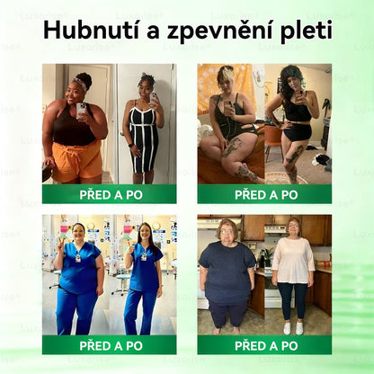 Oficiální obchod  |👩‍⚕️𝗟𝘂𝘅𝗮𝗿𝗶𝘀𝗲® MORINGA X BERBERIN  10-IN-1 Pokročilý Nano Mikrojehly Náplast(Jedna náplast denně, viditelné změny již za 7 dní) ✅ Pomáhá při obezitě, cukrovce, spánkové apnoe, problémech s klouby a dalších potížích🌺