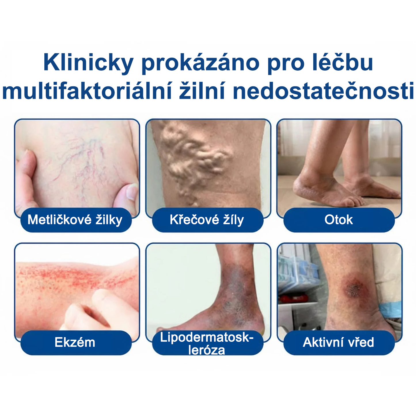 ✅FLORISMA® Klinická mikrojehličková náplast s diosminem a hesperidinem🌿 – zaměřená na křečové a metličkové žilky, pomáhá zmírnit pocit těžkých a unavených nohou
