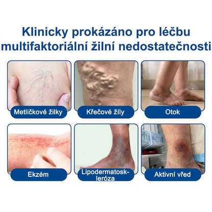 ✅FLORISMA® Klinická mikrojehličková náplast s diosminem a hesperidinem🌿 – zaměřená na křečové a metličkové žilky, pomáhá zmírnit pocit těžkých a unavených nohou