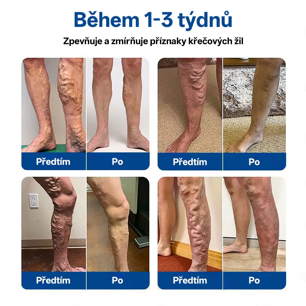 🎁GFOUK® VeinTarget Microneedle Patch |⚡ Okamžitá úleva, dlouhodobé výsledky