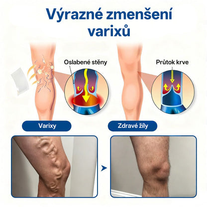 🎁GFOUK® VeinTarget Microneedle Patch |⚡ Okamžitá úleva, dlouhodobé výsledky