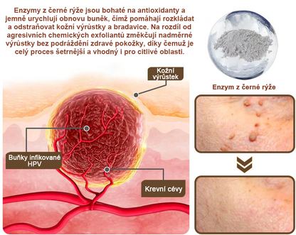 ✅ Pureluxo® Fekete Rizses Bőrregeneráló Krém 👨‍⚕️ (Szemölcsök, bőrkinövések, foltok és hiperpigmentáció kezelésére)✅✅