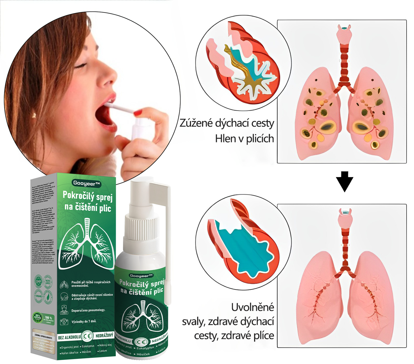 ✅𝐆𝐨𝐨𝐲𝐞𝐞𝐫™ Pokročilý sprej na čištění plic -🧑‍⚕️ Podporuje zdraví plic, průdušek a dutin, napomáhá zdraví dýchacího systému a usnadňuje dýchání.