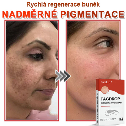 🇨🇿Pureluxo® Mikrovpichová botanická náplast na odstranění kožních výrůstků 🇨🇿 Vyrobeno v Česká republika