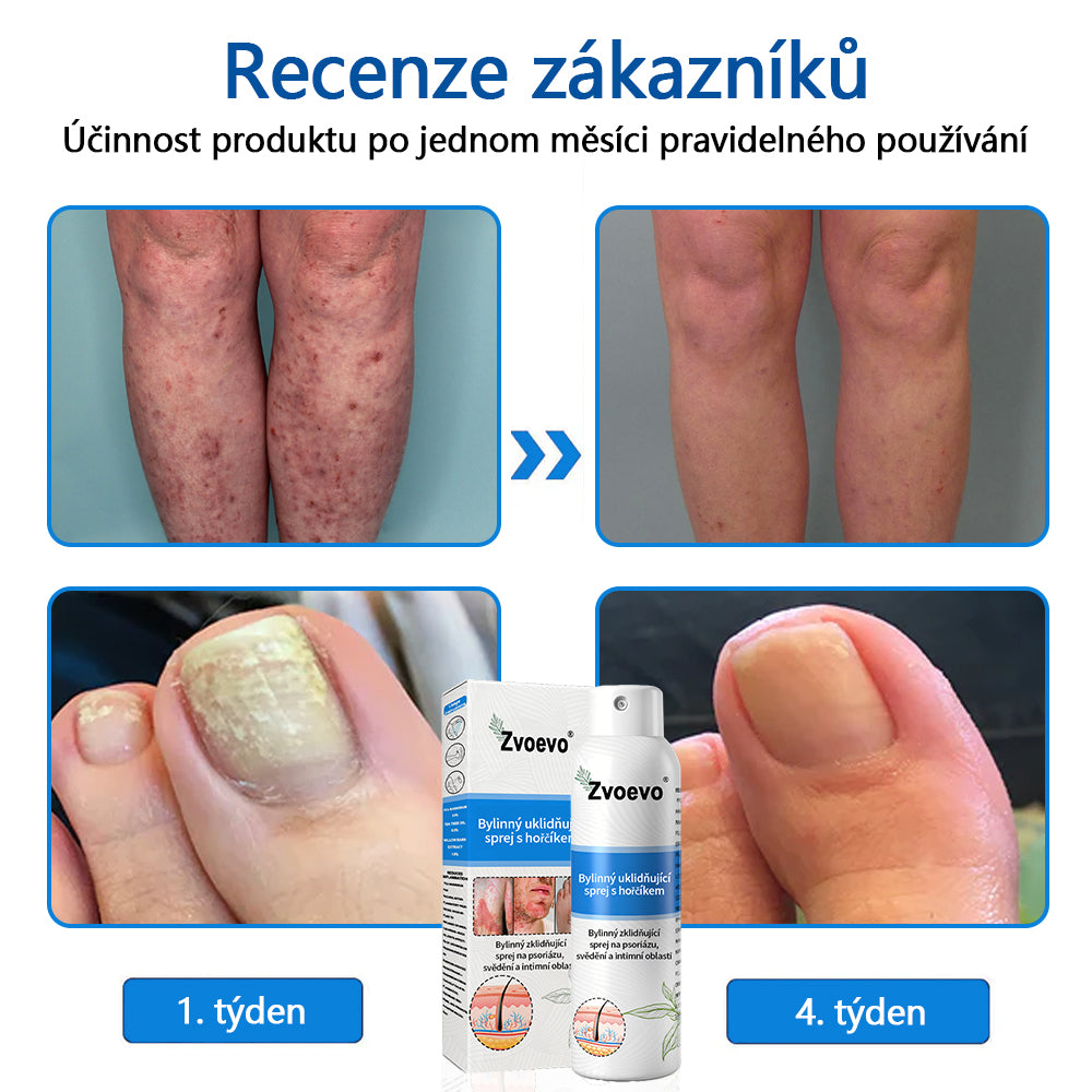 Zvoevo® Magnesium bylinný sprej ⚕️ Certifikace MHRA – úleva při psoriáze, ekzému, intimních bakteriálních infekcích, akné a tmavých skvrnách