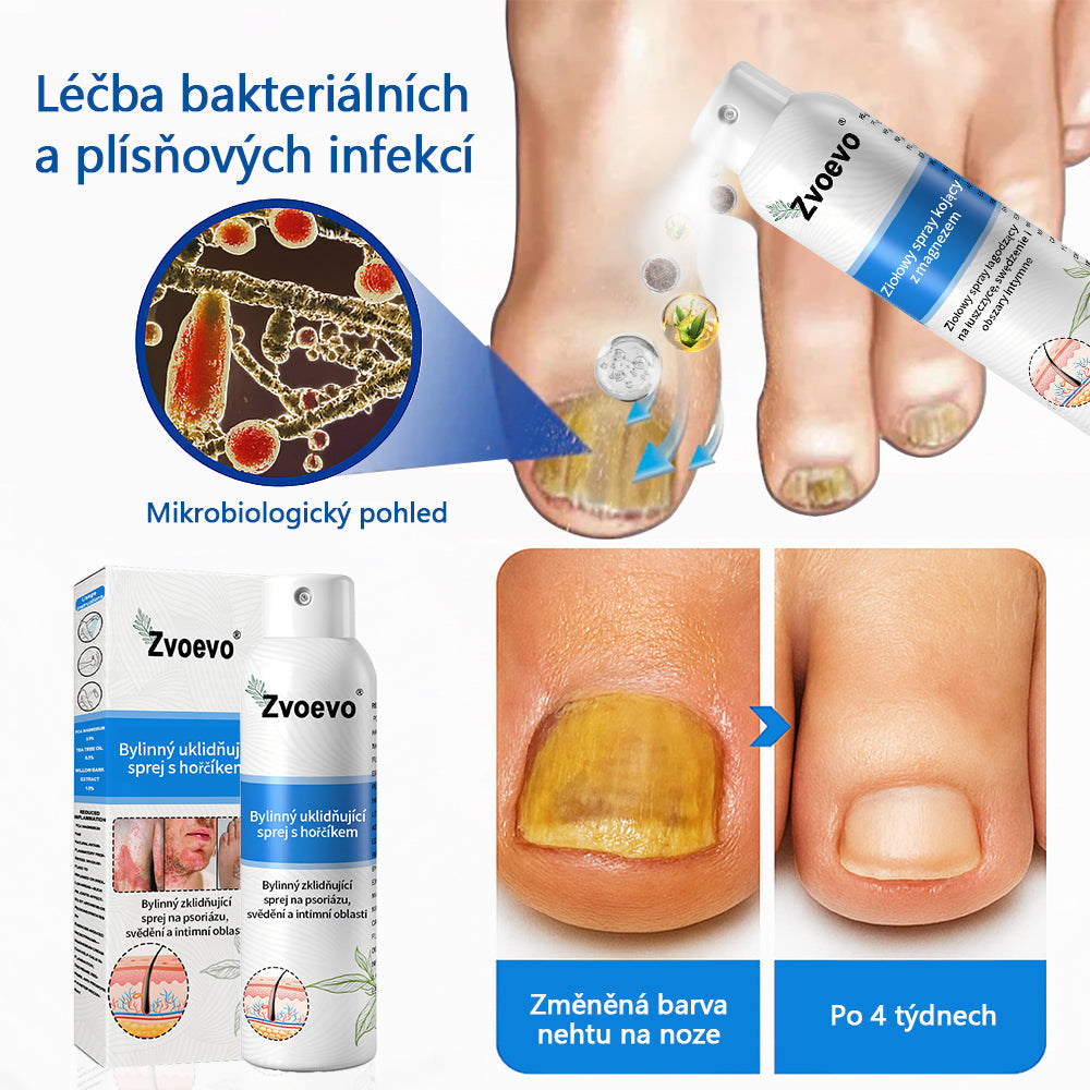 Zvoevo® Magnesium bylinný sprej ⚕️ Certifikace MHRA – úleva při psoriáze, ekzému, intimních bakteriálních infekcích, akné a tmavých skvrnách