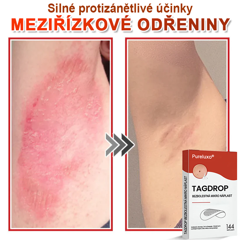 🇨🇿Pureluxo® Mikrovpichová botanická náplast na odstranění kožních výrůstků 🇨🇿 Vyrobeno v Česká republika