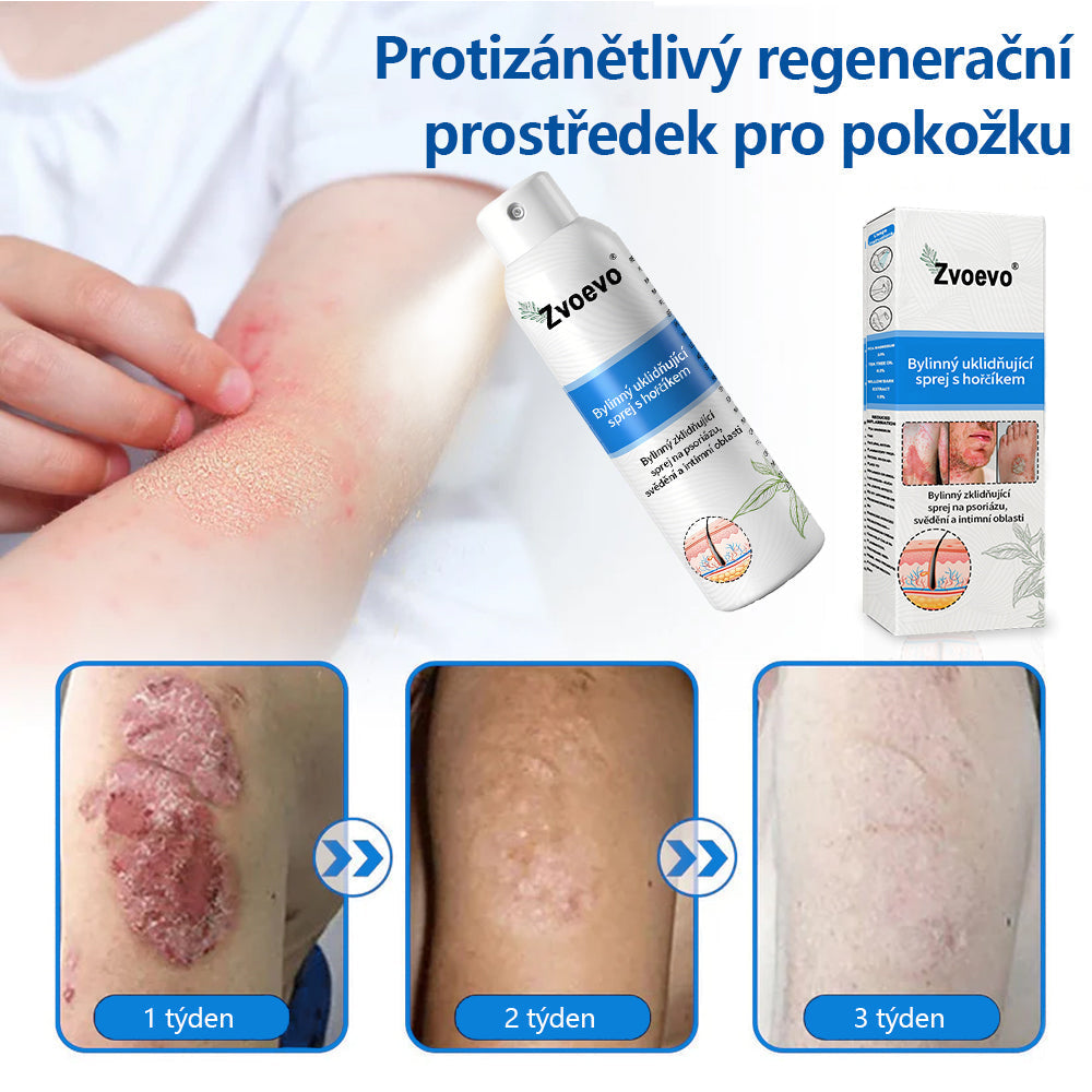 Zvoevo® Magnesium bylinný sprej ⚕️ Certifikace MHRA – úleva při psoriáze, ekzému, intimních bakteriálních infekcích, akné a tmavých skvrnách