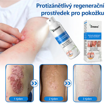Zvoevo® Magnesium bylinný sprej ⚕️ Certifikace MHRA – úleva při psoriáze, ekzému, intimních bakteriálních infekcích, akné a tmavých skvrnách