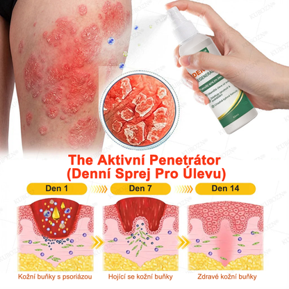⭐KUBOZN® Denní a noční regenerační systém pro psoriázu – 100% bez steroidů, dvojité řešení pro úlevu od plaků, šupinatění a svědění