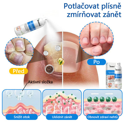 Zvoevo® Magnesium bylinný sprej ⚕️ Certifikace MHRA – úleva při psoriáze, ekzému, intimních bakteriálních infekcích, akné a tmavých skvrnách